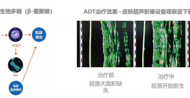 三胎政策激活生育市场，“安美科”用自研技术解决孕妊娠纹烦恼