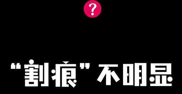 行的每一位郑州美莱—谁还想做双眼皮？保持够久？线条又好？香水实