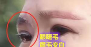 不要再留了女子割双眼皮后变“白眉大侠”，找美容院讨要说法：是手术造成的今年冬